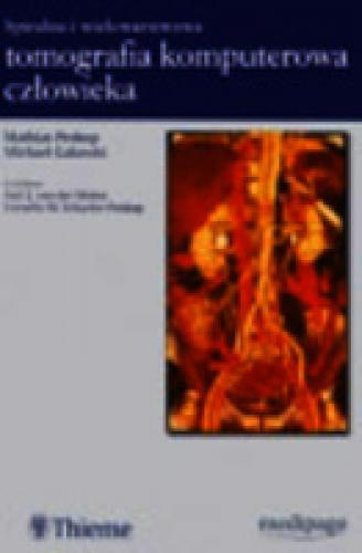 Spiralna i wielowarstwowa tomografia komputerowa człowieka