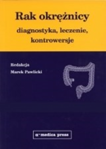 Rak okrężnicy — diagnostyka, leczenie, kontrowersje